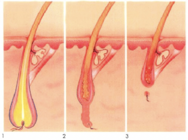 Verschillende fases: groeifase (1), rustfase (2) en uitvalfase (3)
